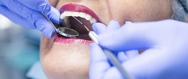 Best Emergency Gum Treatment in St Francis, KS